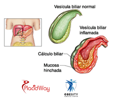 Slider image (7) Obesity Surgical Center | Dr. Jorge Reyes Mendiola